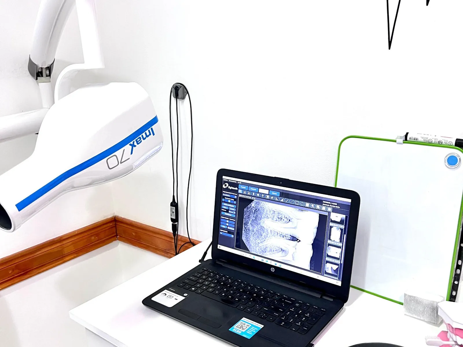 Equipo de rayos digital con la radiografía en la computadora