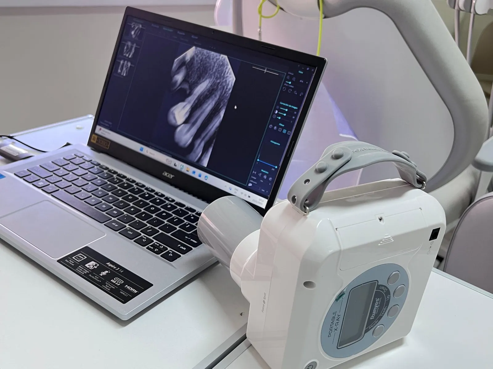 Rayos X portátil y la radiografía en pantalla